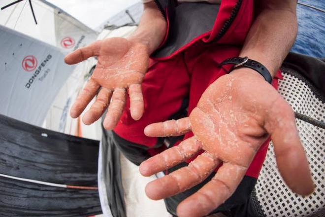 Onboard Dongfeng Race Team – Sailors hands - Leg six to Newport – Volvo Ocean Race 2015 ©  Sam Greenfield / Volvo Ocean Race
